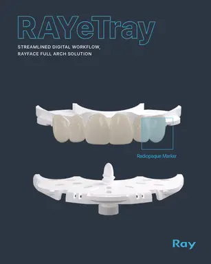 RAYeTray_Flyer_v1.1_251016