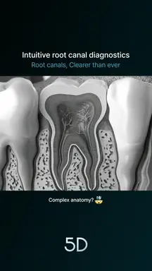 05. Intuitive root canal diagnostics