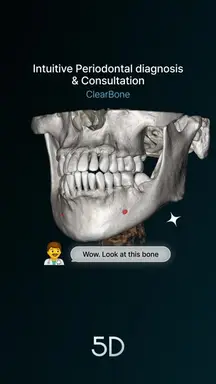 Intuitive Periodontal diagnosis & consulation(ClearBone)_260211_EN