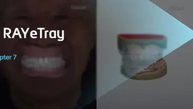 #7_RAYeTray_Guide
