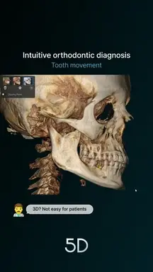 16 Intuitive orthodontic diagnosis – Tooth movement