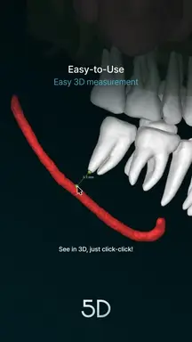 11. Easy-to-Use_Easy 3D measurement