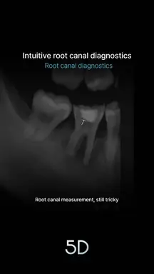 12. Intuitive root canal diagnostics