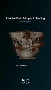 Intuitive Perio and Implant planning(ClearBone)_260211_EN (1)