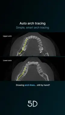 03. Auto arch tracing
