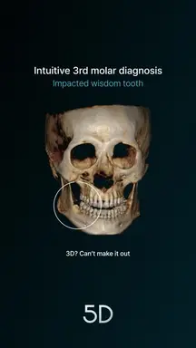 08. Intuitive 3rd molar diagnosis