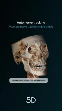 02. Auto nerve tracking