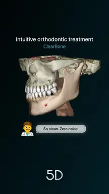 Intuitive orthodontic treatment_Palatine suture(ClearBone)_260211_EN